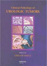 Clinical Pathology of Urological Tumours