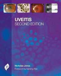 Uveitis