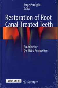 Restoration of Root Canal-Treated Teeth