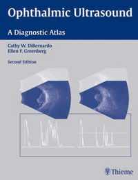 Ophthalmic Ultrasound