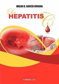 La Hepatitis C